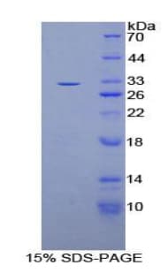 Rat OSMR / IL-31R-Beta Protein (Recombinant His-T7)