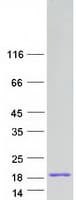 Human KAAG1 Protein (Recombinant Myc-DDK (Flag))