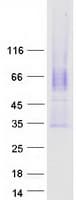 Human CACNG5 Protein (Recombinant Myc-DDK (Flag))