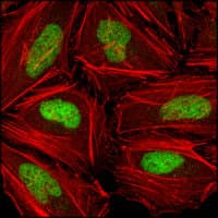 CHEK2 / CHK2 Antibody (clone 1C12B8)