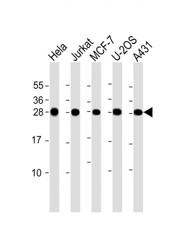 RPL14 / Ribosomal Protein L14 Antibody (aa173-204)