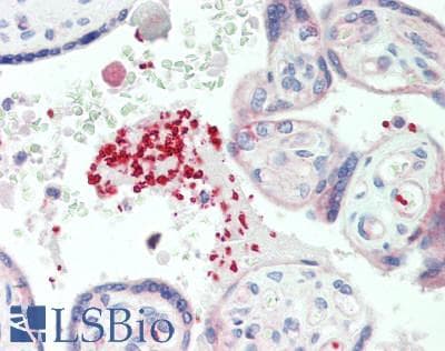 Polyclonal Rabbit anti-Human GP1BA / CD42b Antibody (aa19-291, IHC, WB)