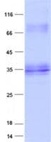 Human MED7 / CRSP9 Protein (Recombinant His, N-Terminal)