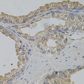 Polyclonal Rabbit anti-Human ARF1 Antibody (IHC, WB)