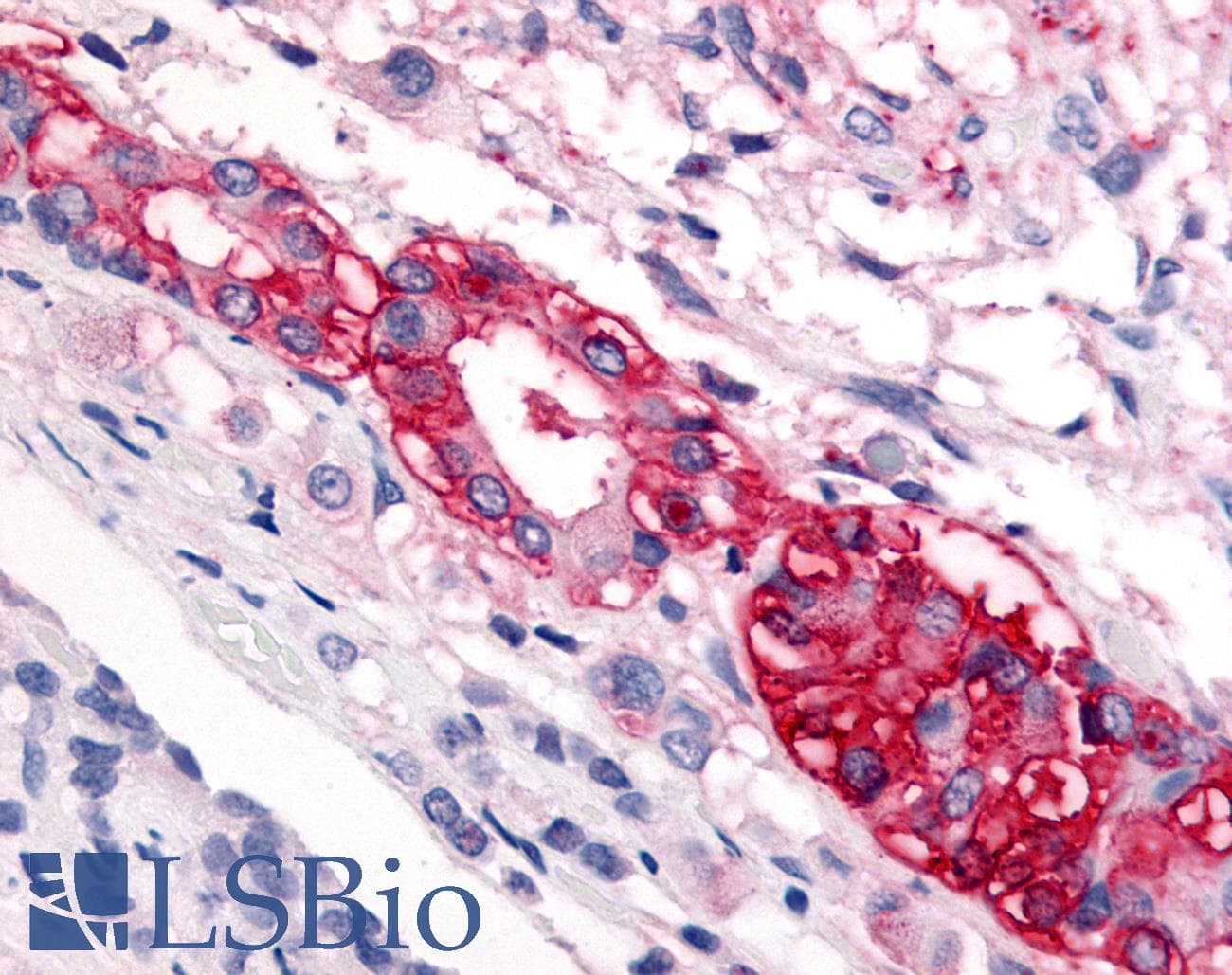 PathPlus™ Polyclonal Rabbit anti-Human CRFR1 / CRHR1 Antibody (Extracellular Domain, IHC)