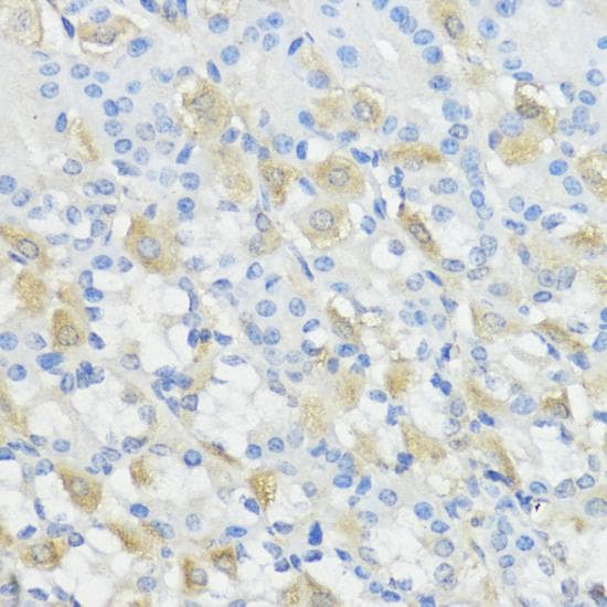 Polyclonal Rabbit anti-Human GPX2 Antibody (IHC)