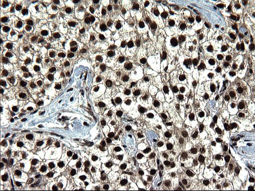 RPRD1B Antibody (clone OTI1C9)