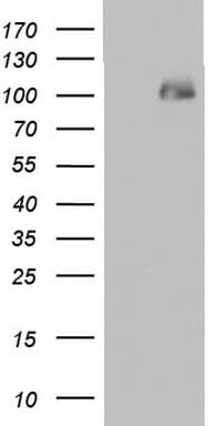 PMEL / SILV / gp100 Antibody (clone OTI3G5)