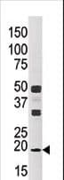 Polyclonal Rabbit anti-Human NME3 Antibody (aa51-81, IHC, WB)