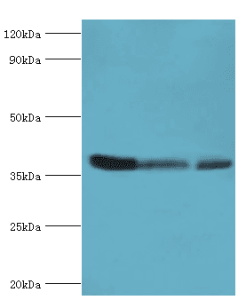 ARG2 / Arginase 2 Antibody (aa1-354)