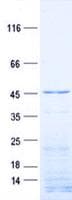 Human ACTR6 Protein (Recombinant His, N-Terminal)