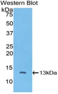 PathPlus™ CTNNBIP1 / ICAT Antibody (aa1-81)