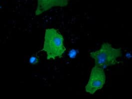 PRKD2 / PKD2 Antibody (clone OTI3F7)