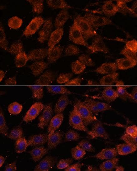 Polyclonal Rabbit anti-Human TNM / Teneurin-1 Antibody (IF, WB)