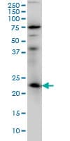RAB3A Antibody (clone 4H7)