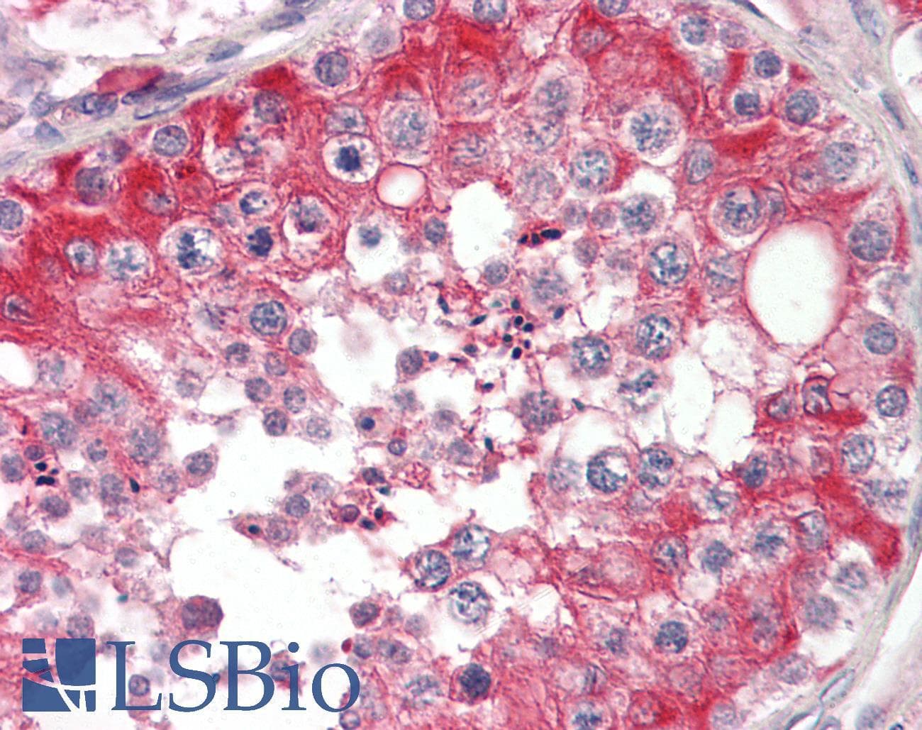 PathPlus™ Polyclonal Goat anti-Human EFNB2 / Ephrin B2 Antibody (aa62-74, IHC, WB)