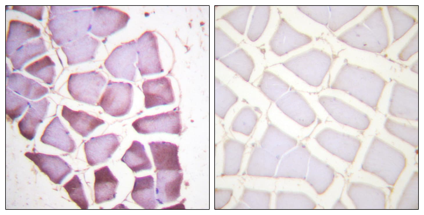 RPS6 / Ribosomal Protein S6 Antibody (phospho-Ser240)