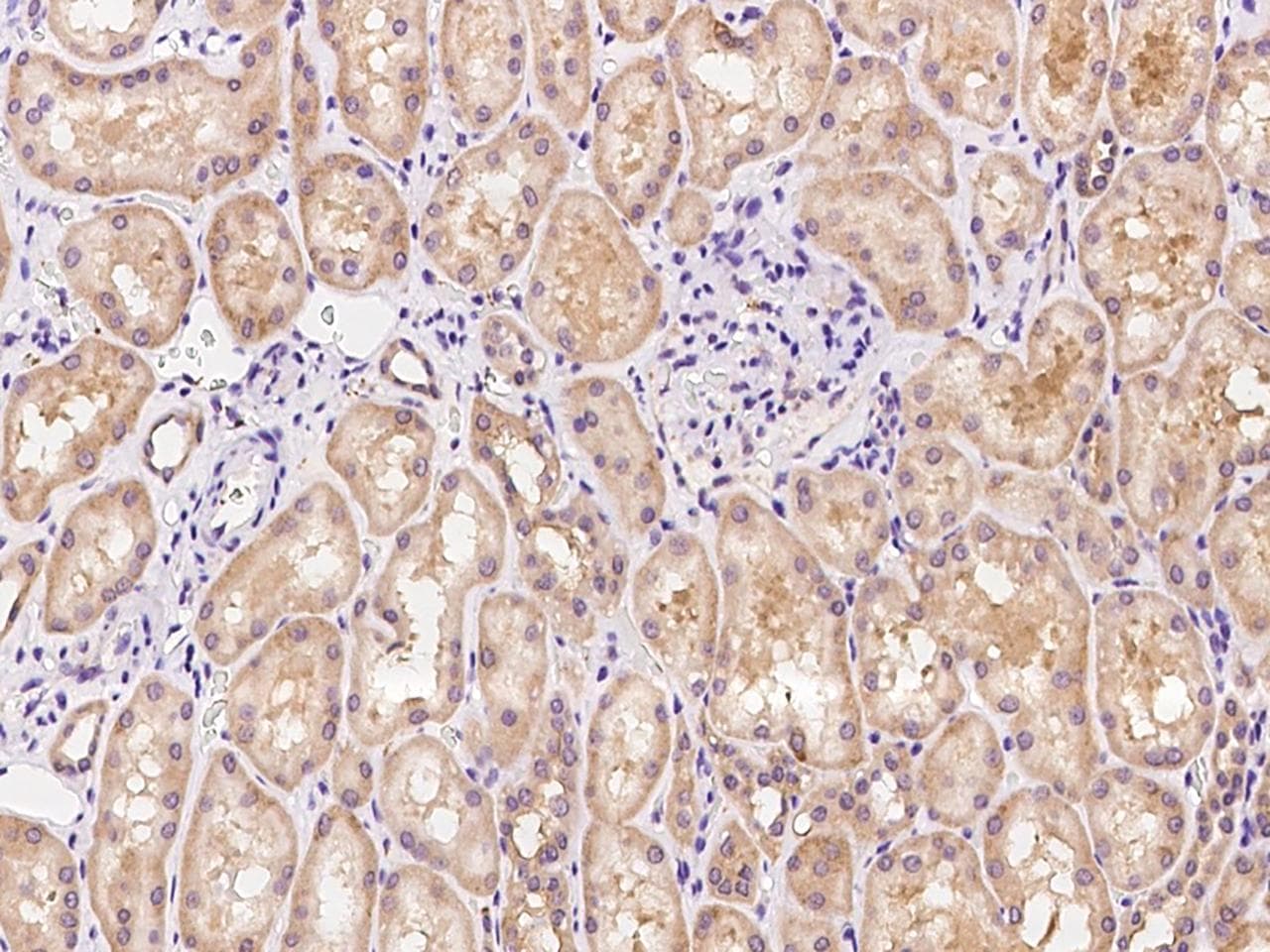 Polyclonal Rabbit anti-Human TNN / Tenascin N Antibody (IHC)
