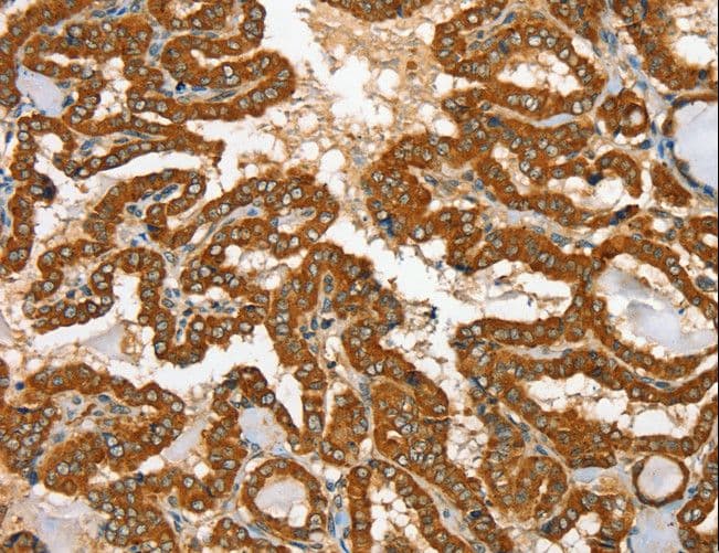 RAB25 Antibody
