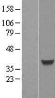 FOXH1 Protein (Over-Expression Lysate Myc-DDK (Flag))