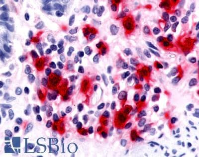 PathPlus™ MST1R / RON Antibody (C-Terminus)