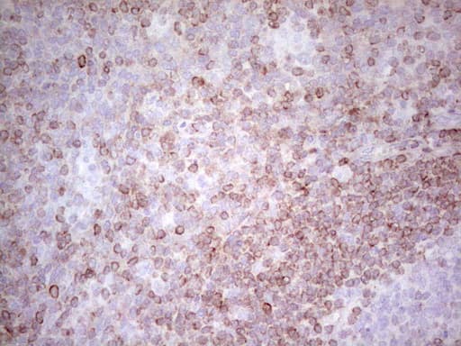 Monoclonal Mouse anti-Human BCL2 / Bcl-2 Antibody (clone OTI3B8, IHC, WB)