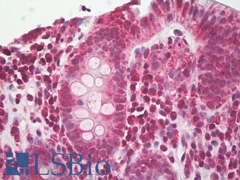 Polyclonal Rabbit anti-Human NALP3 / NLRP3 Antibody (Biotin, aa158-207, IHC, WB)