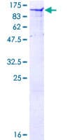Human CAST / Calpastatin Protein (Recombinant GST)