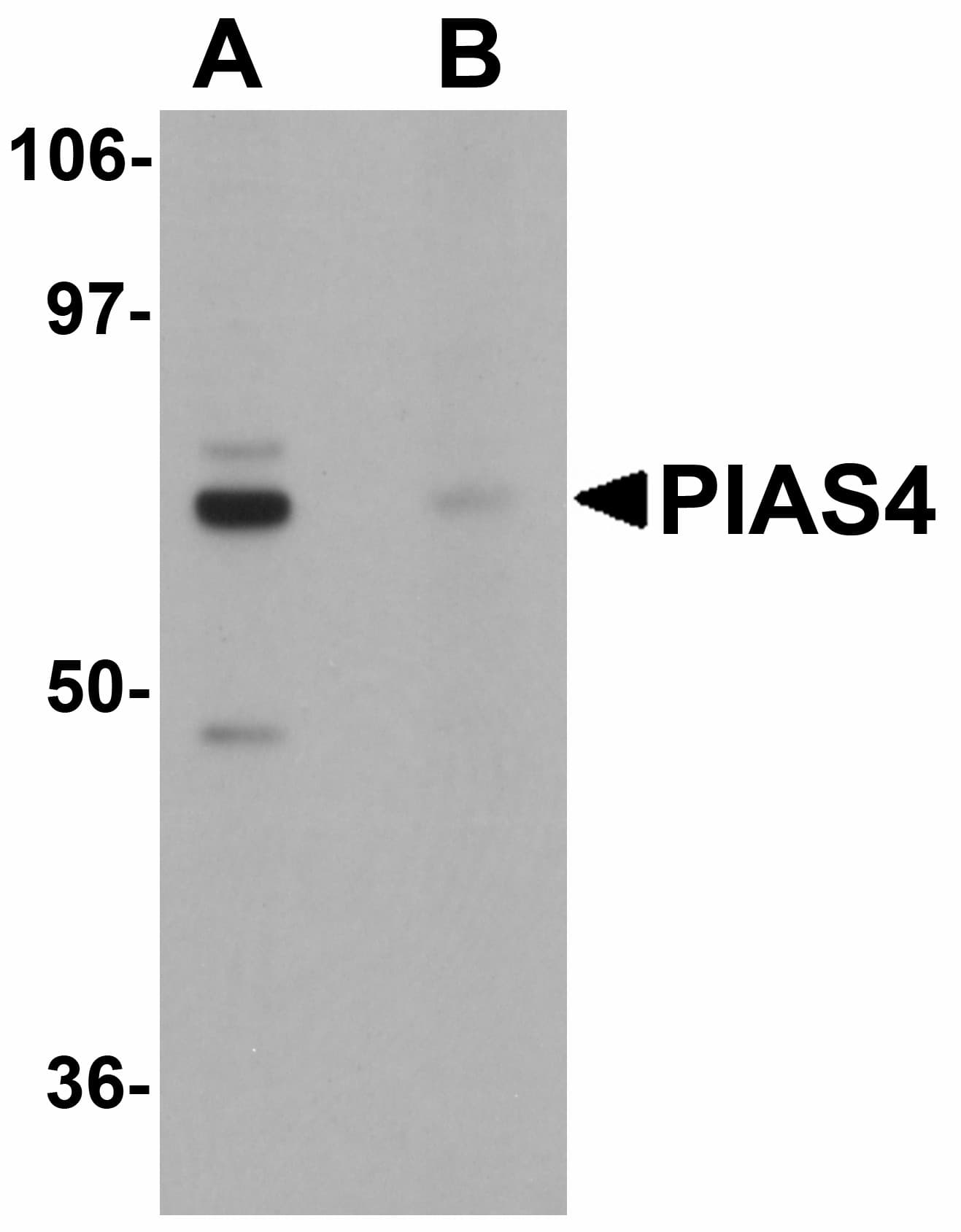 PIAS4 / PIASY Antibody