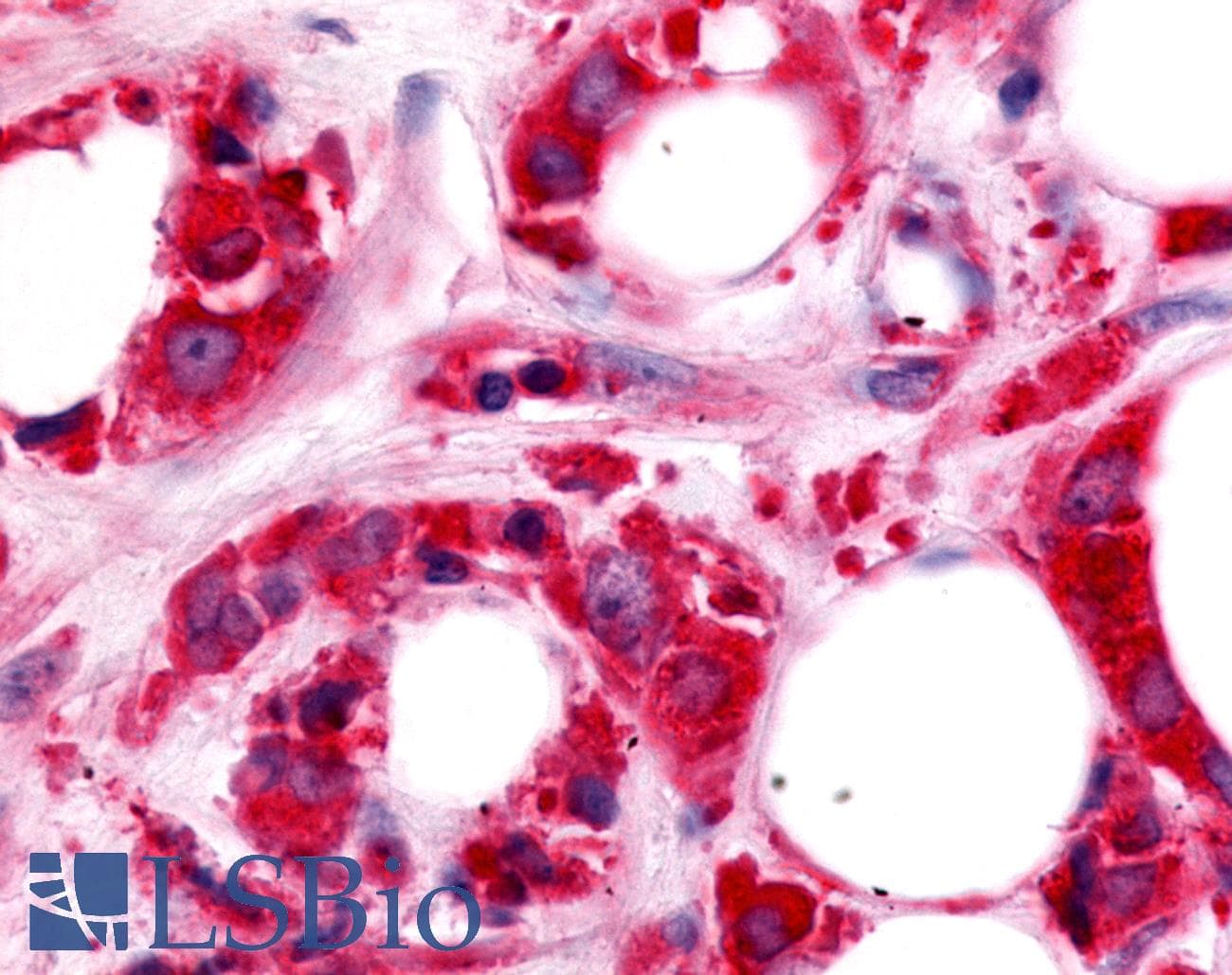 PathPlus™ Polyclonal Rabbit anti-Human HUNK / B19 Antibody (Kinase Domain, IHC)