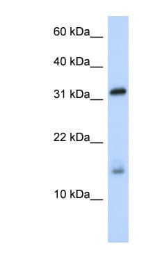 Polyclonal Rabbit anti-Human EIF1AX Antibody (C-Terminus, WB)