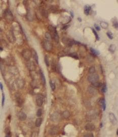 RPL29 / Ribosomal Protein L29 Antibody