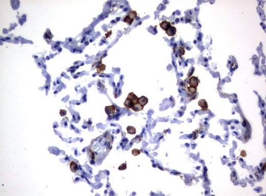 FCGR1A / CD64 Antibody (clone UMAB74, Carrier-free)