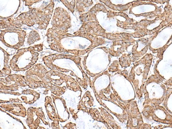 Polyclonal Rabbit anti-Human Arkadia / RNF111 Antibody (IHC)