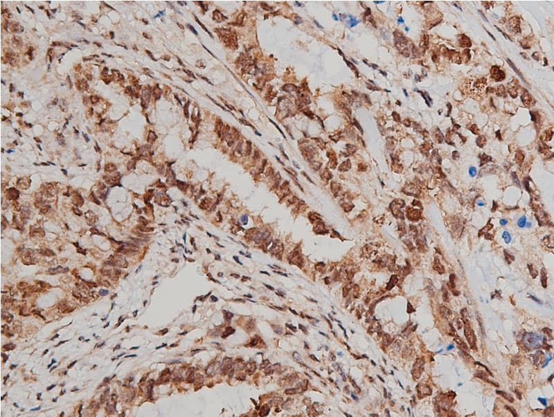 AKT1 Antibody (phospho-Ser473)