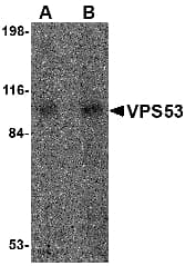 HCCS1 / VPS53 Antibody
