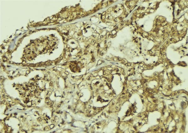 PPAN Antibody