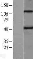 TMPRSS5 Protein (Over-Expression Lysate Myc-DDK (Flag))