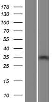 Human ZCCHC16 Protein (Over-Expression Lysate Myc-DDK (Flag))