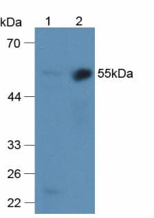 SERPINF2 / Alpha-2-Antiplasmin Antibody (aa340-491)