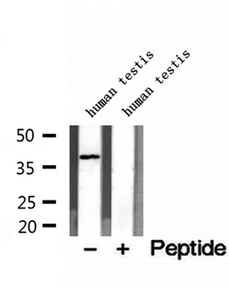 Polyclonal Rabbit anti-Human DNAJB14 Antibody (IHC, IF, WB)
