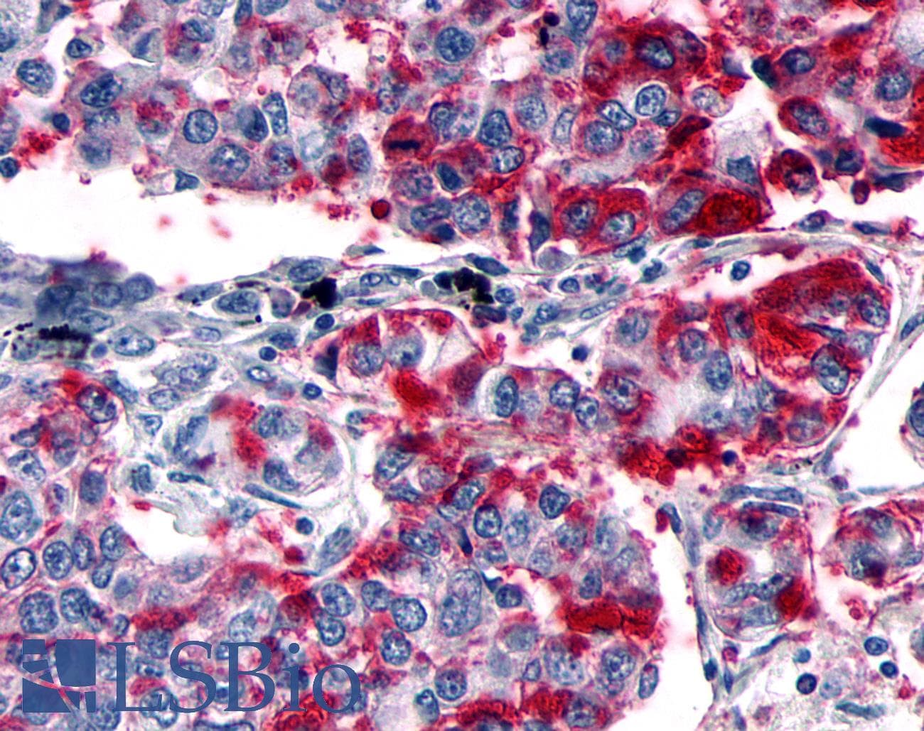 PathPlus™ Polyclonal Rabbit anti-Human GPER1 / GPR30 Antibody (Extracellular Domain, IHC, IF)