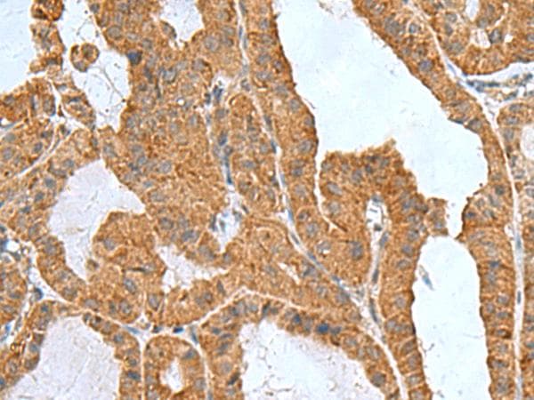 ITGB1BP1 / ICAP1 Antibody