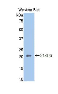 THBD / CD141 / Thrombomodulin Antibody (aa324-480)
