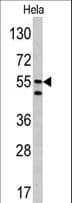CA9 / Carbonic Anhydrase IX Antibody (aa113-143)