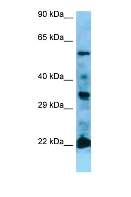 NRAS / N-ras Antibody (aa91-140)