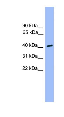 CSNK1A1L Antibody (C-Terminus)