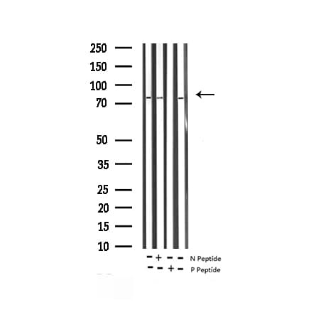 BRAF / B-Raf Antibody (phospho-Thr599)