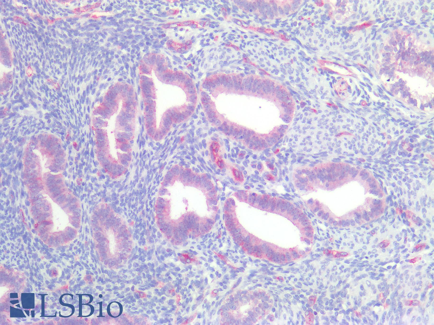 PathPlus™ CLDN5 / Claudin 5 Antibody (C-Terminus)