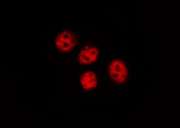 PTPN11 / SHP-2 / NS1 Antibody (phospho-Tyr580)